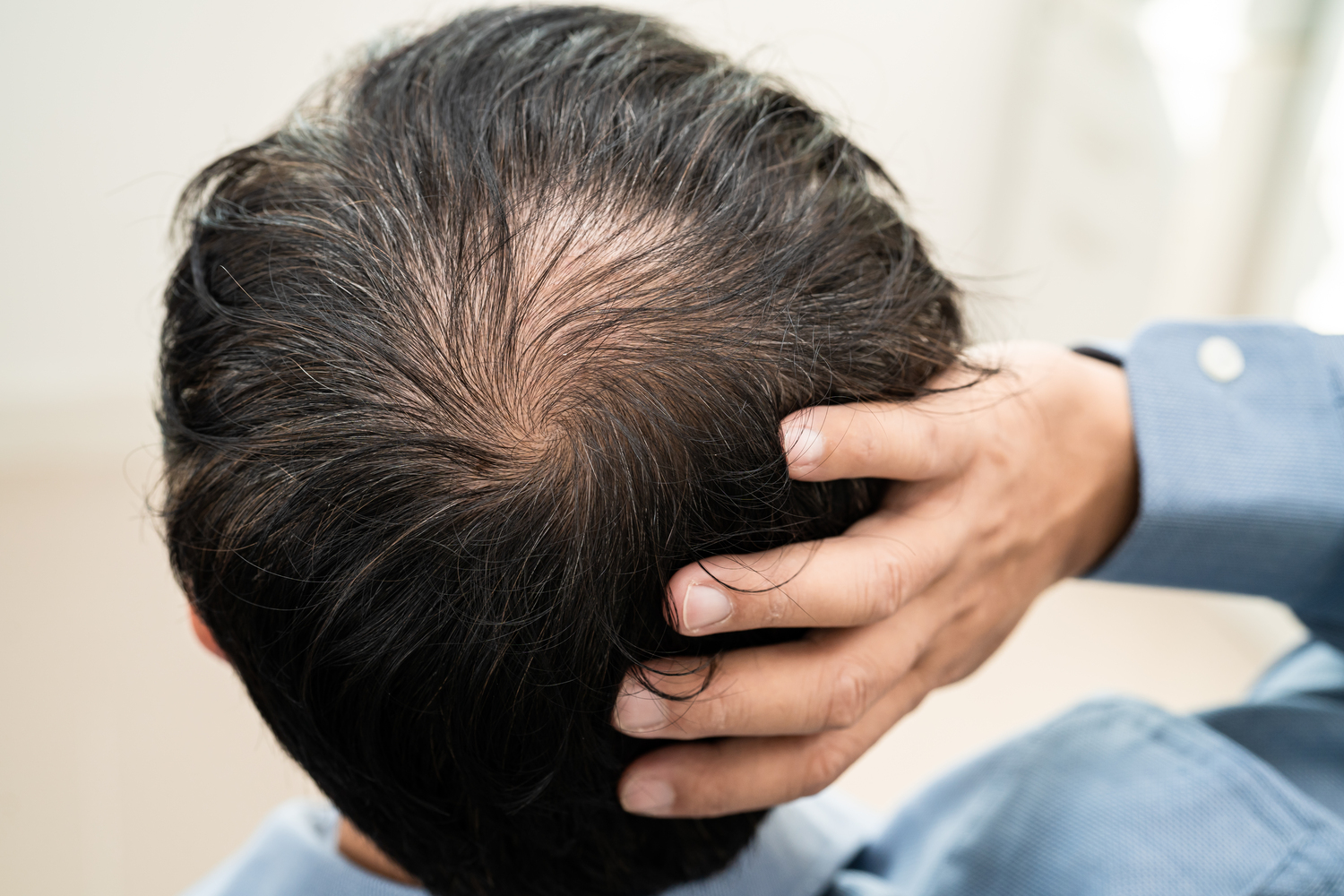 bald middle head begin no loss hair glabrous mature asian business smart active office man -