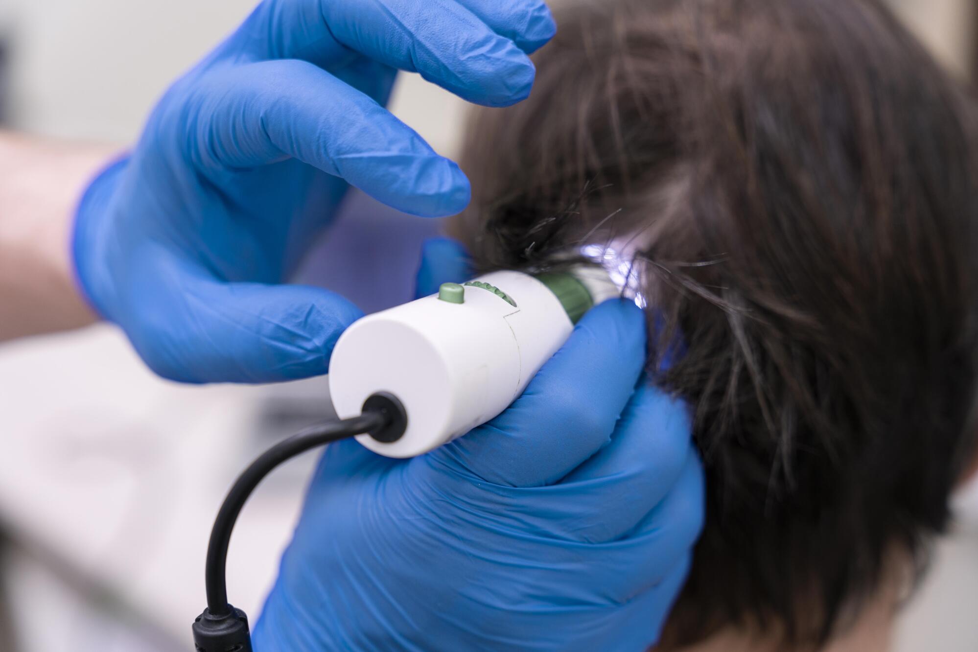 man getting hair loss treatment -