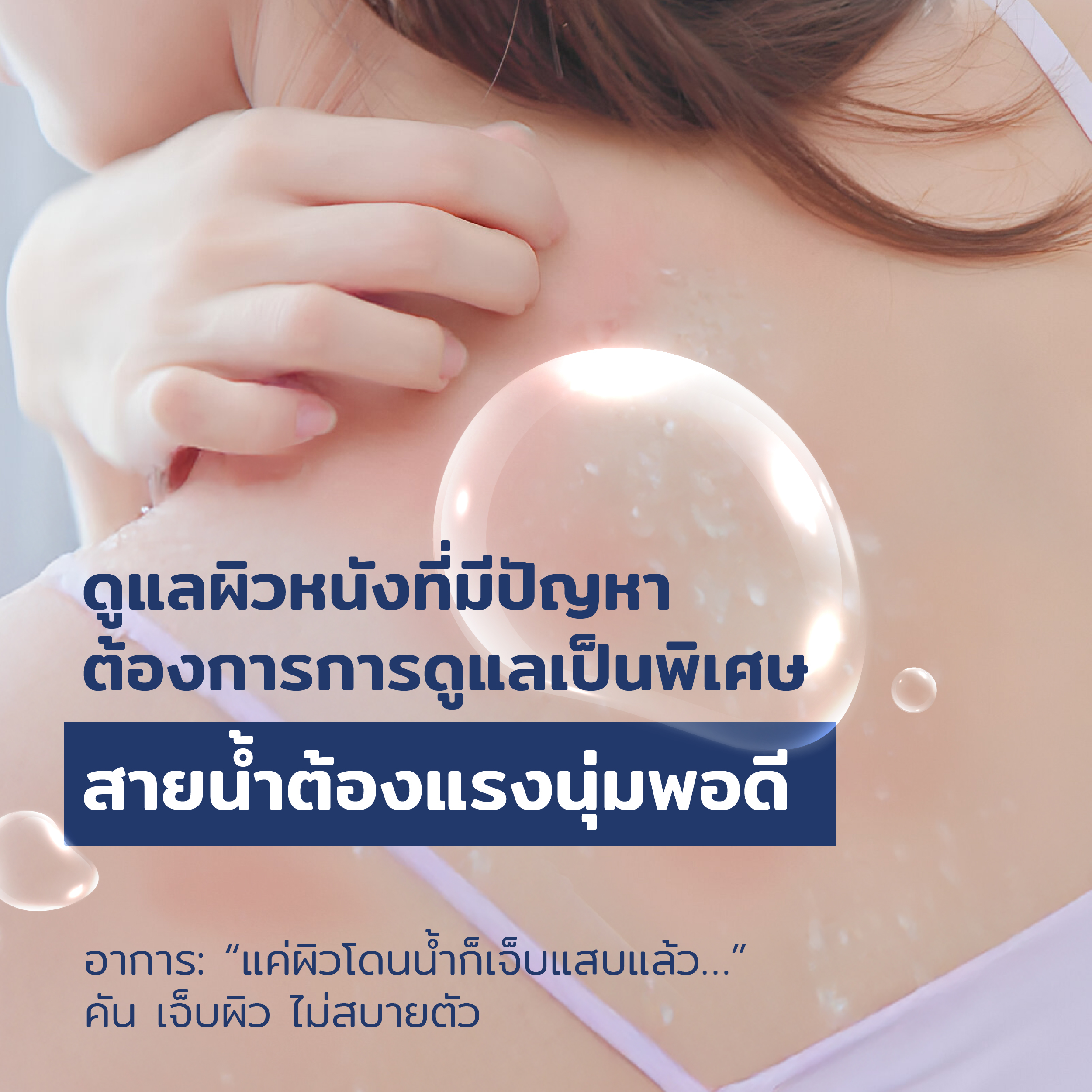 content mook ชีวิตผิวเปลี่ยน ถ้าน้ำแรงไม่พอดี 04 -