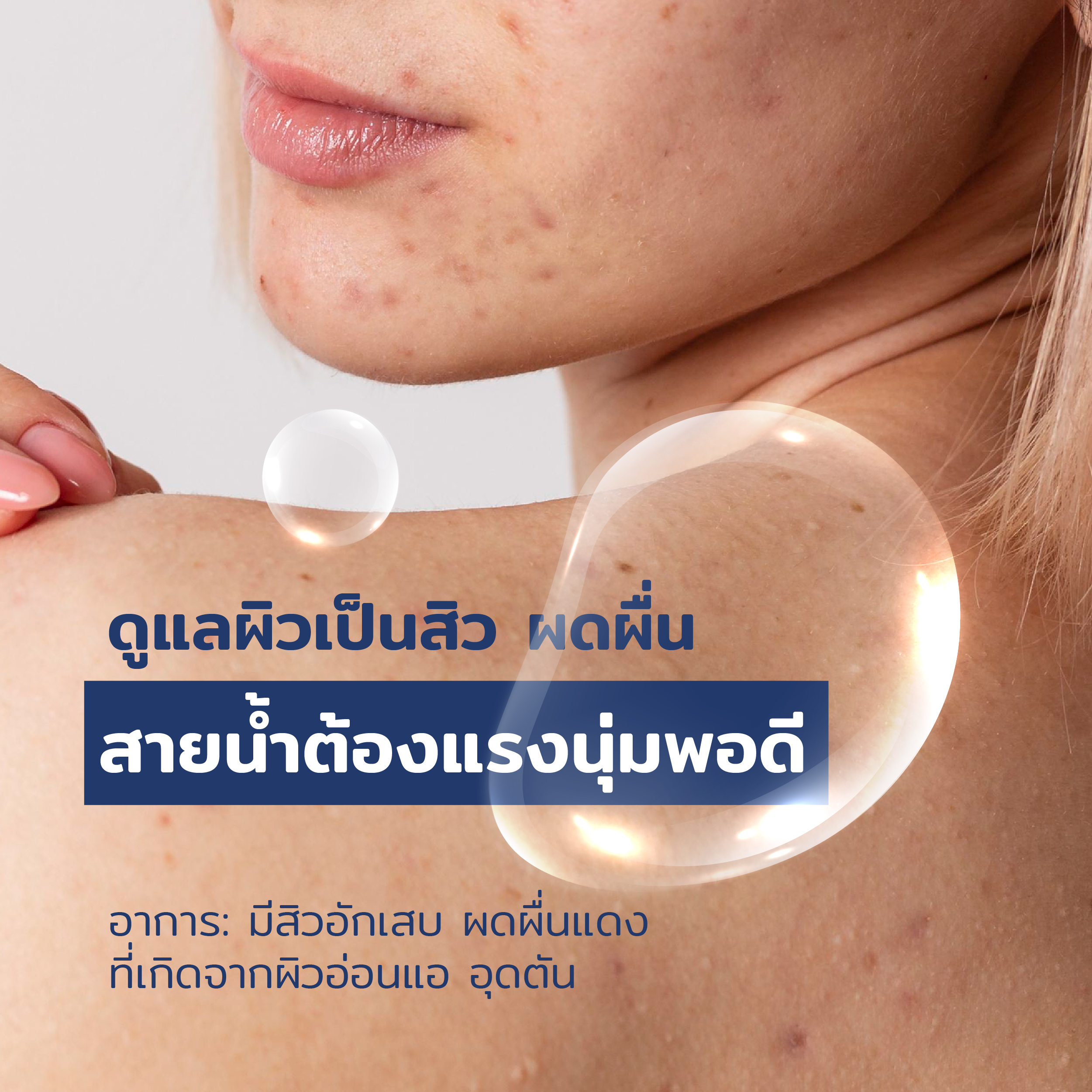 content mook ชีวิตผิวเปลี่ยน ถ้าน้ำแรงไม่พอดี 05 -
