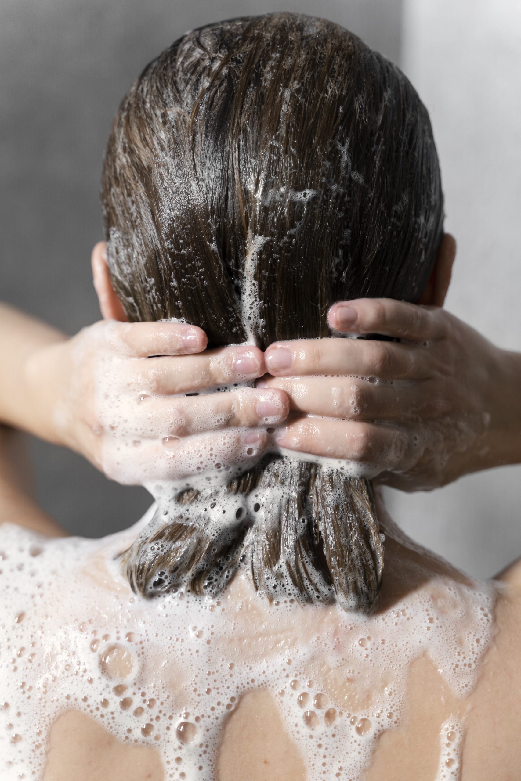 young woman applying anti dandruff product 1 scaled -